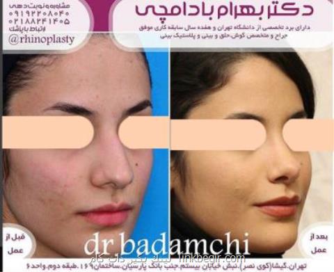 جراحی زیبایی بینی جراحی زیبایی بینی